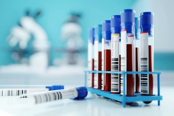 Image representing Get Test Results